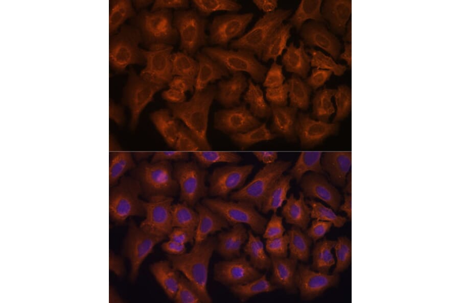 Immunofluorescence - Anti-Nexilin/F-actin-binding protein Antibody (A91295) - Antibodies.com