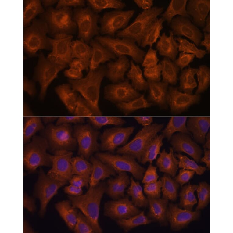 Immunofluorescence - Anti-Nexilin/F-actin-binding protein Antibody (A91295) - Antibodies.com