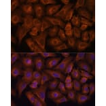 Immunofluorescence - Anti-Nexilin/F-actin-binding protein Antibody (A91295) - Antibodies.com