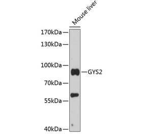 Western Blot - Anti-Glycogen synthase 2 Antibody (A91296) - Antibodies.com