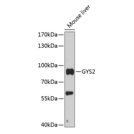 Western Blot - Anti-Glycogen synthase 2 Antibody (A91296) - Antibodies.com