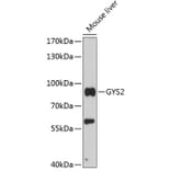 Western Blot - Anti-Glycogen synthase 2 Antibody (A91296) - Antibodies.com