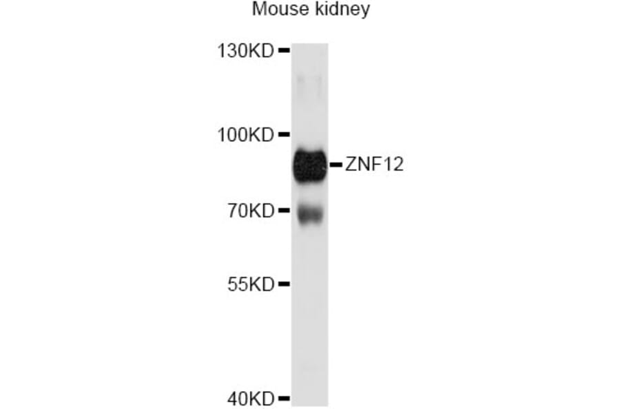 Western Blot - Anti-ZNF12 Antibody (A13783) - Antibodies.com