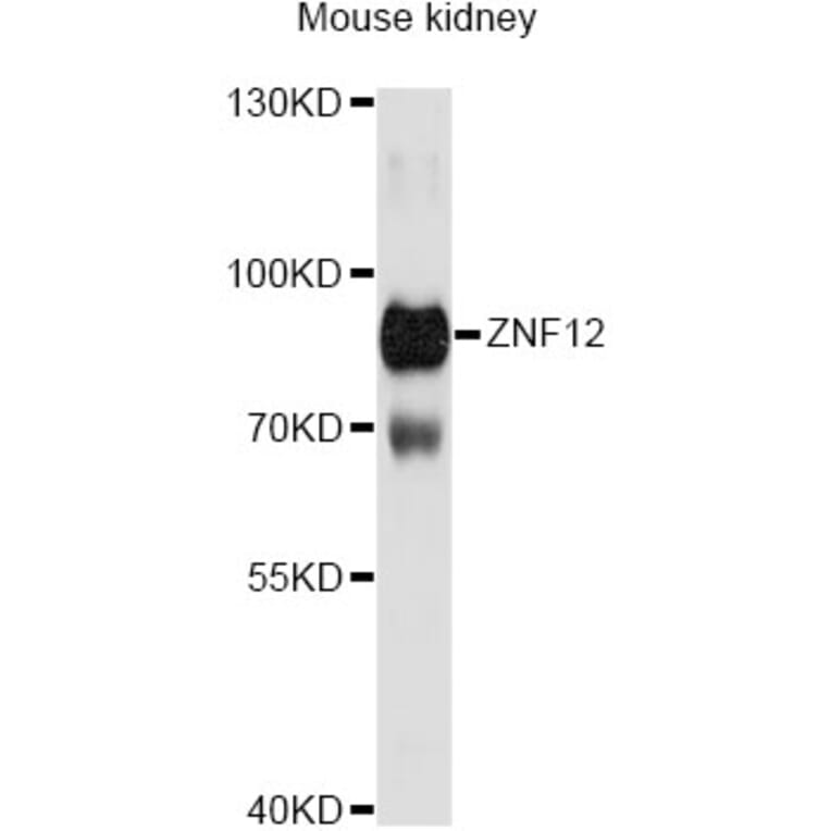 Western Blot - Anti-ZNF12 Antibody (A13783) - Antibodies.com
