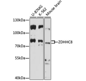 Western Blot - Anti-ZDHHC8 Antibody (A91298) - Antibodies.com