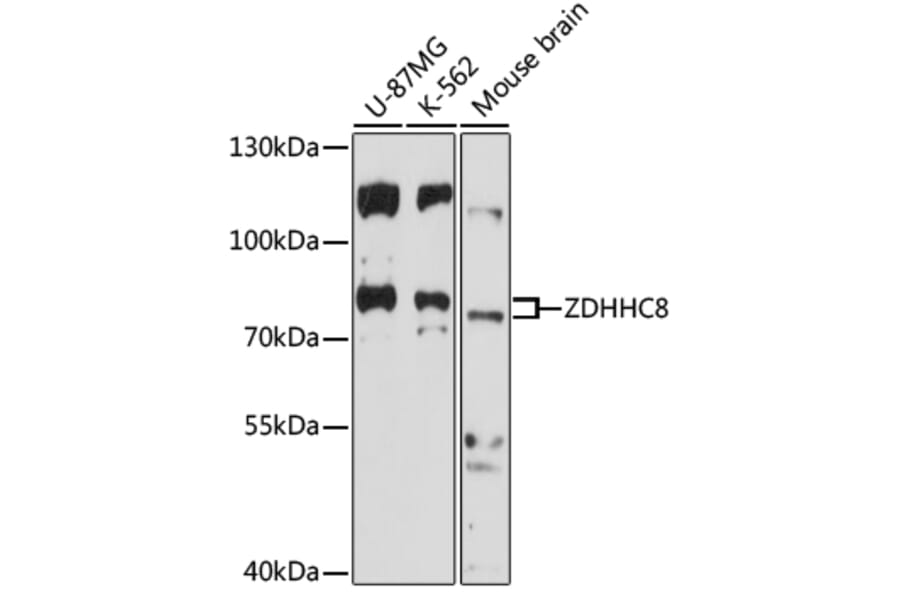 Western Blot - Anti-ZDHHC8 Antibody (A91298) - Antibodies.com