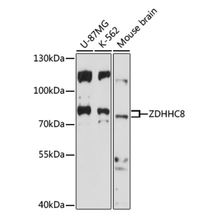 Western Blot - Anti-ZDHHC8 Antibody (A91298) - Antibodies.com