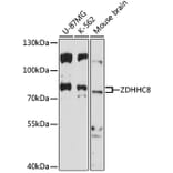 Western Blot - Anti-ZDHHC8 Antibody (A91298) - Antibodies.com