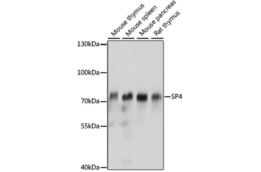 Western Blot - Anti-Transcription factor Sp4 Antibody (A91299) - Antibodies.com