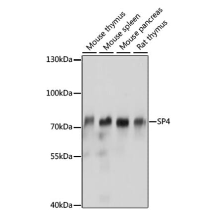 Western Blot - Anti-Transcription factor Sp4 Antibody (A91299) - Antibodies.com