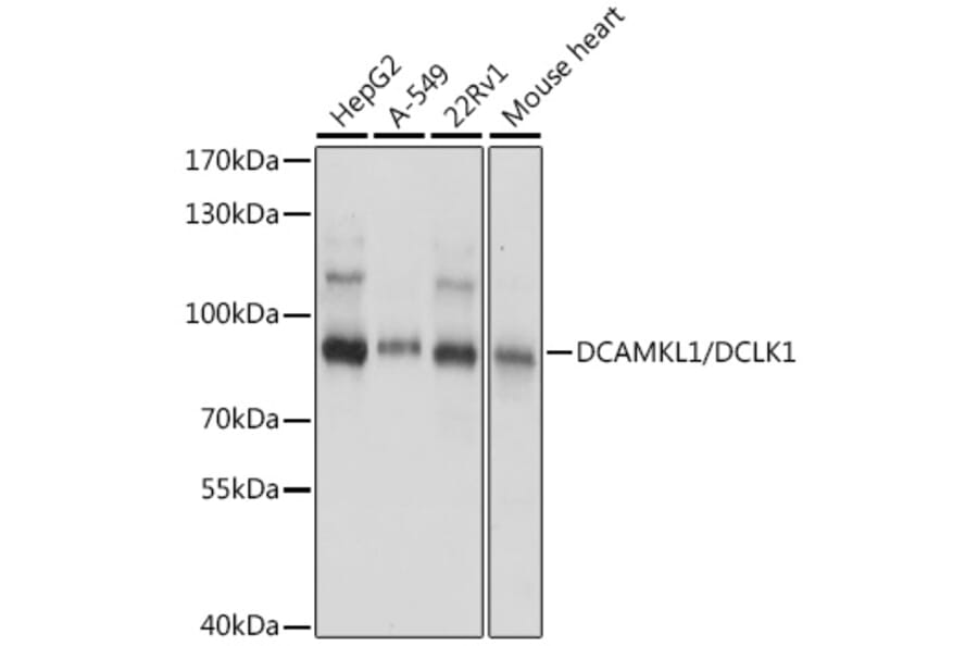Western Blot - Anti-DCAMKL1 Antibody (A91300) - Antibodies.com