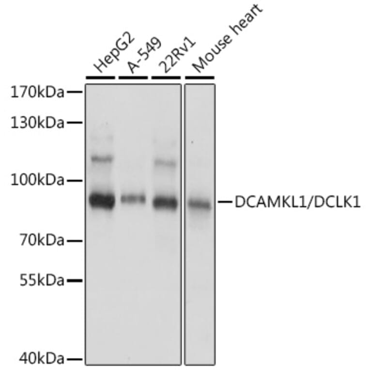 Western Blot - Anti-DCAMKL1 Antibody (A91300) - Antibodies.com