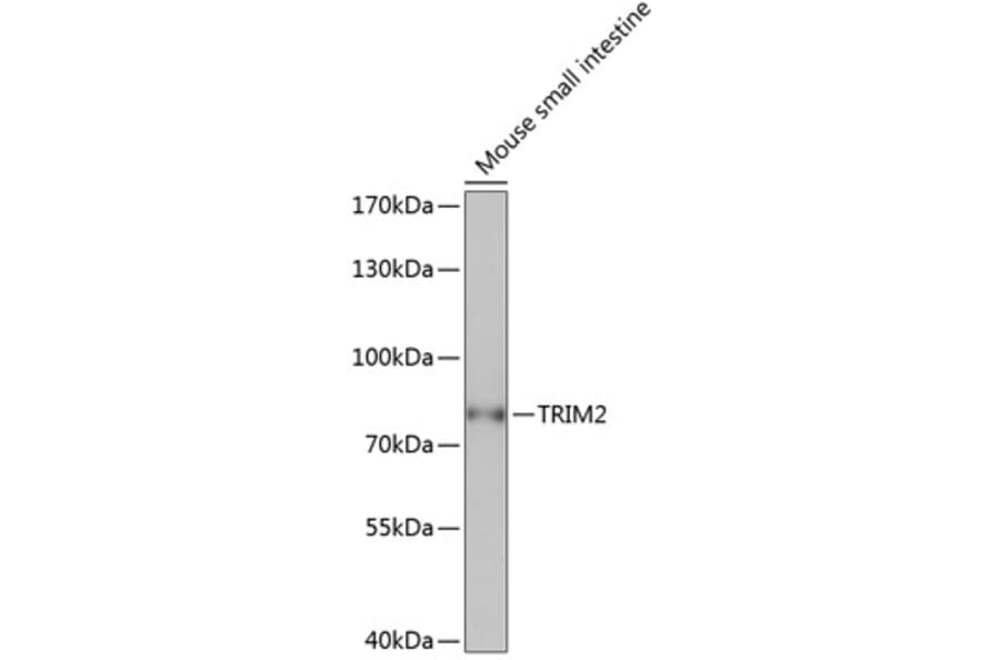 Western Blot - Anti-TRIM2 Antibody (A91301) - Antibodies.com