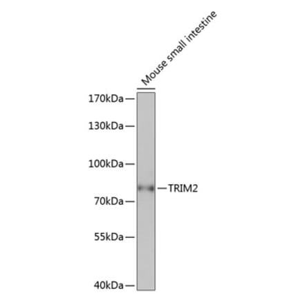 Western Blot - Anti-TRIM2 Antibody (A91301) - Antibodies.com