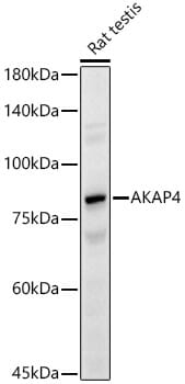 Western blot analysis of extracts of various cell lines, using Anti-AKAP4 Antibody (A14813) at 1:1,000 dilution.
Secondary antibody: Goat Anti-Rabbit IgG (H+L) (HRP) (AS014) at 1:10,000 dilution.
Lysates / proteins: 25µg per lane.
Blocking buffer: 3% non-fat dry milk in TBST.
Detection: ECL Enhanced Kit (RM00021).
Exposure time: 3s.