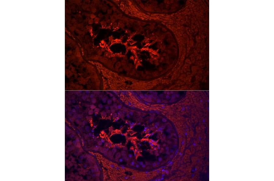 Immunofluorescence - Anti-AKAP4 Antibody (A91303) - Antibodies.com