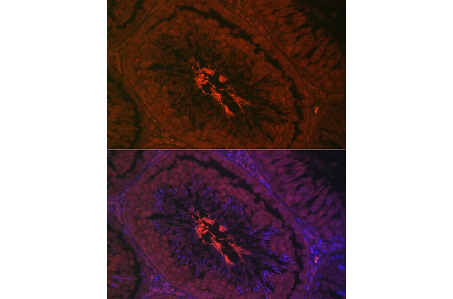 Immunofluorescence - Anti-AKAP4 Antibody (A91303) - Antibodies.com