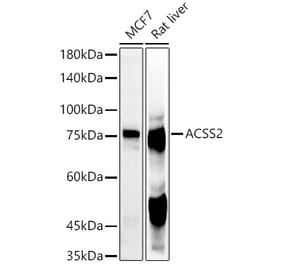 Western Blot - Anti-ACSS2 Antibody (A91305) - Antibodies.com