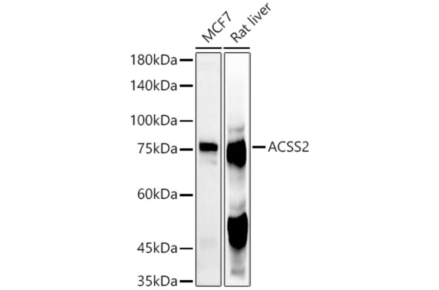 Western Blot - Anti-ACSS2 Antibody (A91305) - Antibodies.com