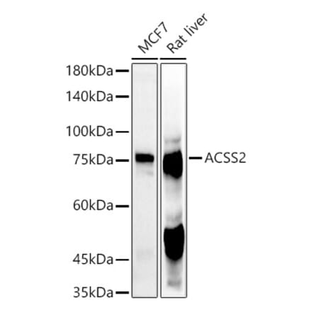 Western Blot - Anti-ACSS2 Antibody (A91305) - Antibodies.com