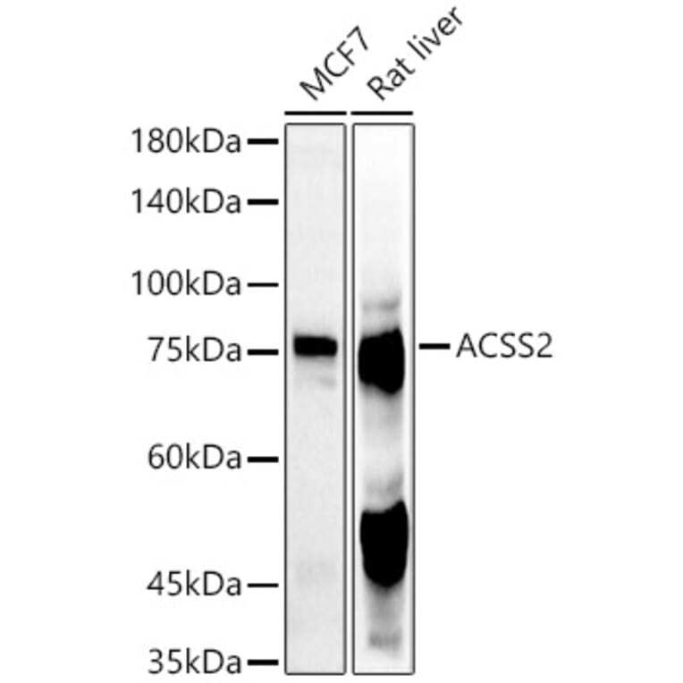 Western Blot - Anti-ACSS2 Antibody (A91305) - Antibodies.com