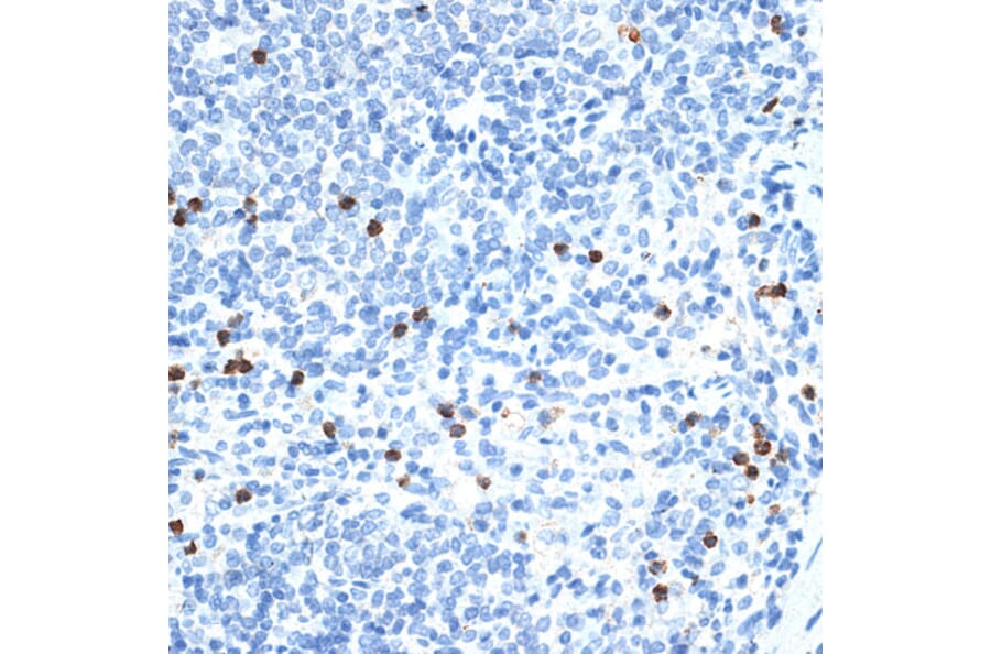 Immunohistochemistry - Anti-MMP9 Antibody (A91306) - Antibodies.com