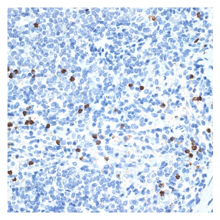 Immunohistochemistry - Anti-MMP9 Antibody (A91306) - Antibodies.com