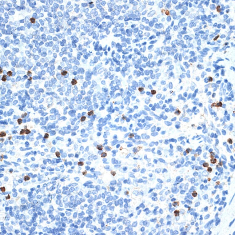 Immunohistochemistry - Anti-MMP9 Antibody (A91306) - Antibodies.com