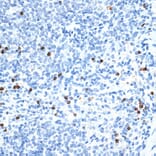 Immunohistochemistry - Anti-MMP9 Antibody (A91306) - Antibodies.com