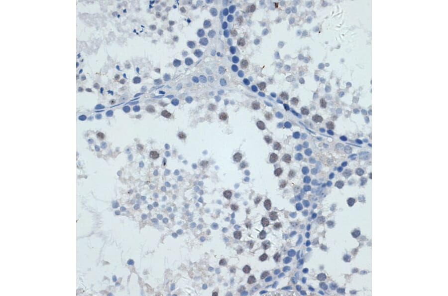 Immunohistochemistry - Anti-MMP9 Antibody (A91306) - Antibodies.com