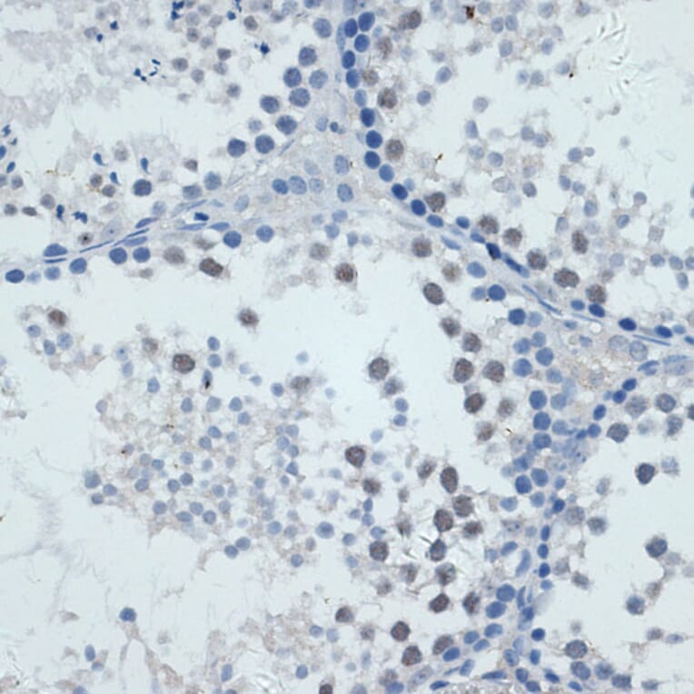 Immunohistochemistry - Anti-MMP9 Antibody (A91306) - Antibodies.com