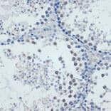 Immunohistochemistry - Anti-MMP9 Antibody (A91306) - Antibodies.com