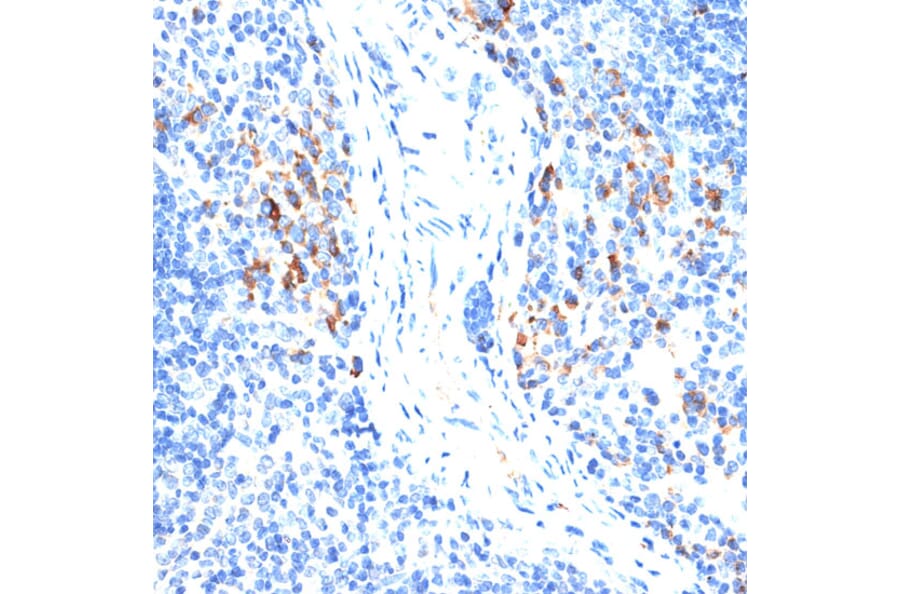 Immunohistochemistry - Anti-MMP9 Antibody (A91306) - Antibodies.com
