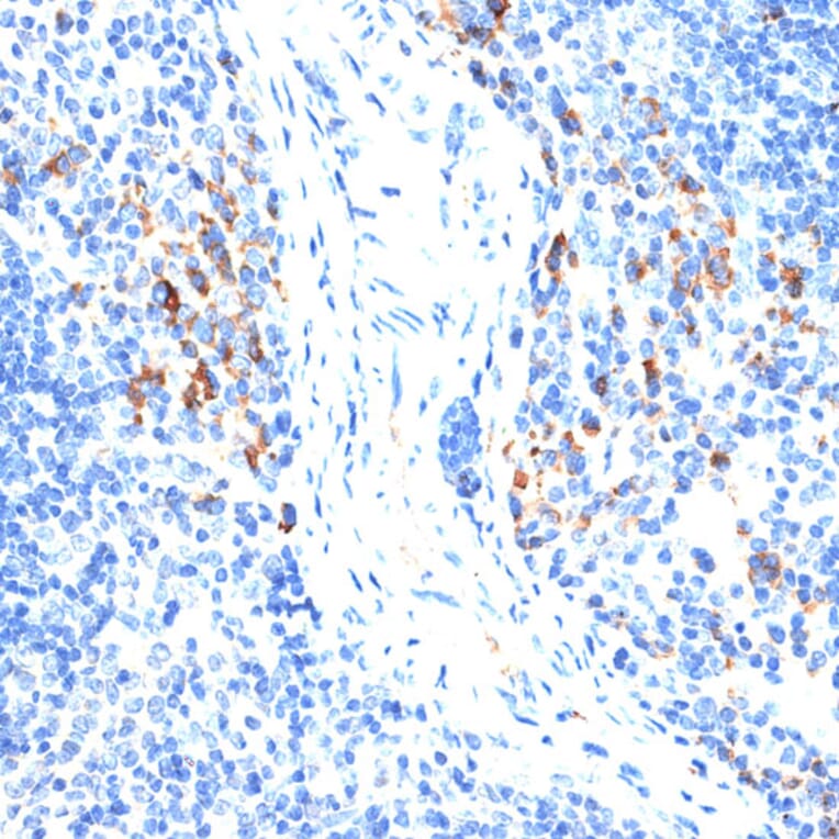 Immunohistochemistry - Anti-MMP9 Antibody (A91306) - Antibodies.com