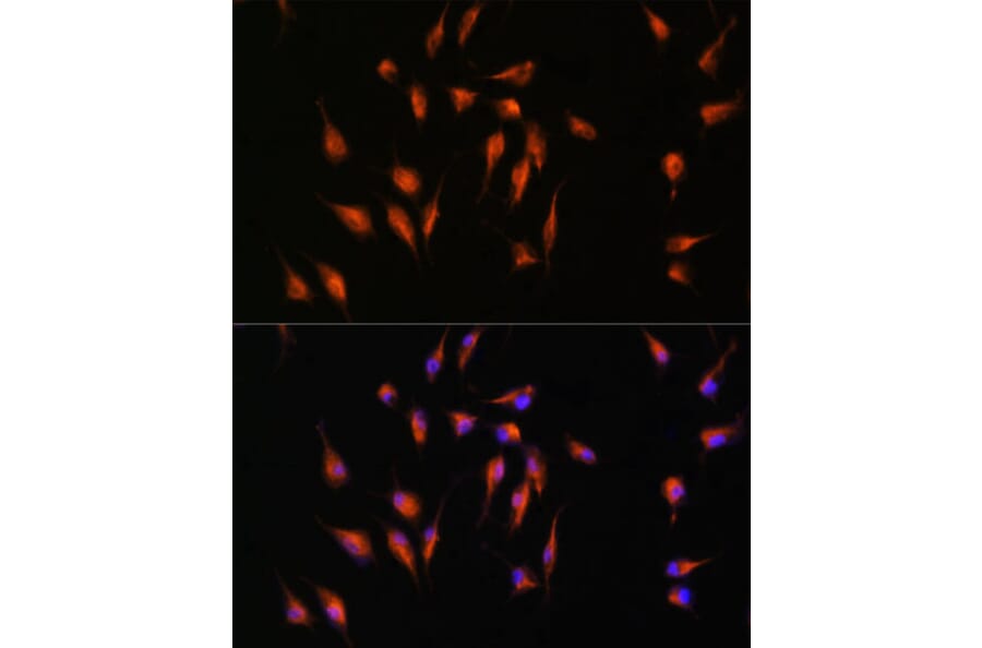 Immunofluorescence - Anti-MMP9 Antibody (A91306) - Antibodies.com