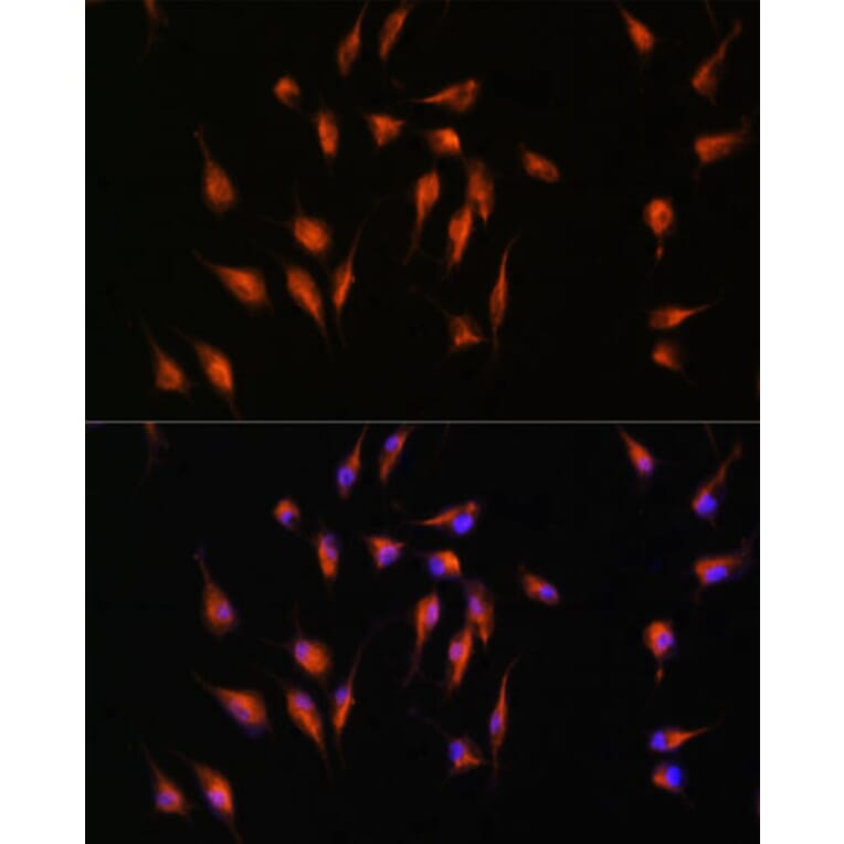 Immunofluorescence - Anti-MMP9 Antibody (A91306) - Antibodies.com