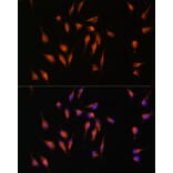 Immunofluorescence - Anti-MMP9 Antibody (A91306) - Antibodies.com