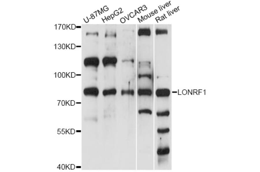Western Blot - Anti-LONRF1 Antibody (A14433) - Antibodies.com