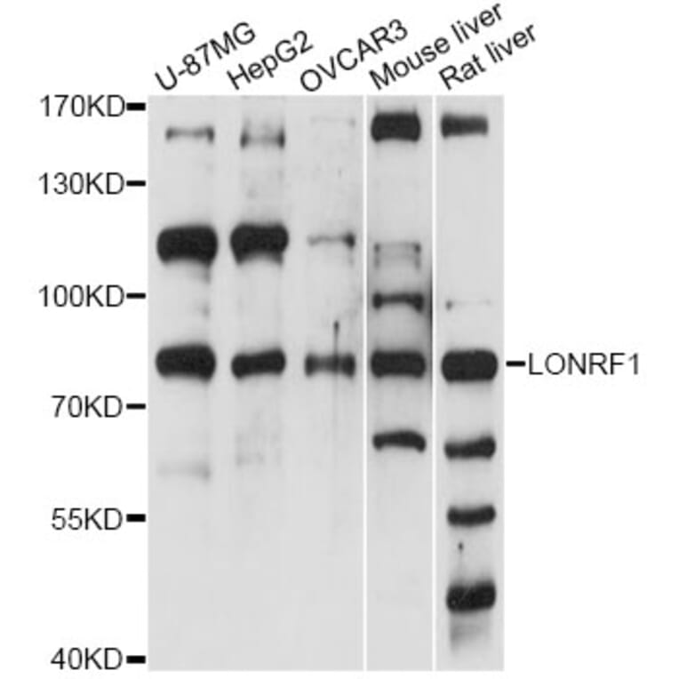 Western Blot - Anti-LONRF1 Antibody (A14433) - Antibodies.com