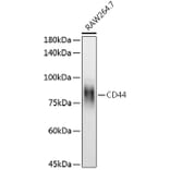 Western Blot - Anti-CD44 Antibody (A91308) - Antibodies.com