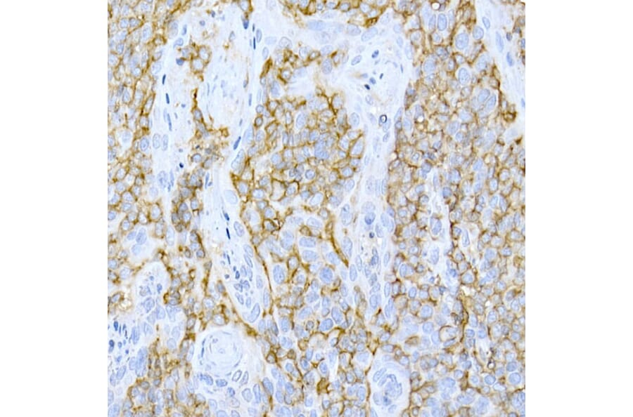 Immunohistochemistry - Anti-CD44 Antibody (A91308) - Antibodies.com