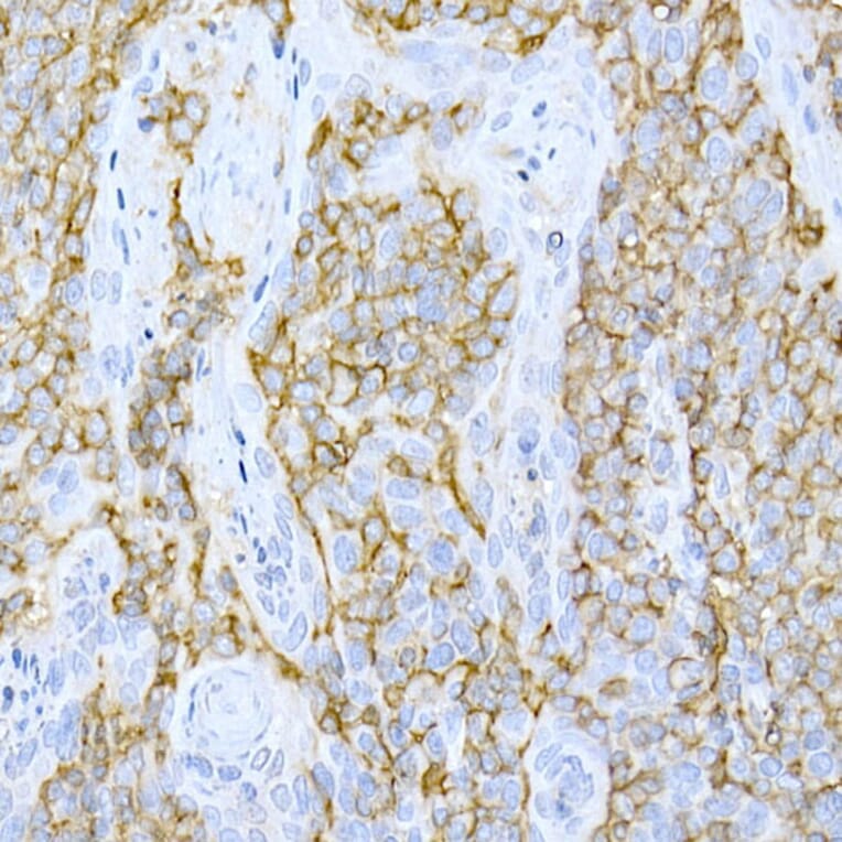 Immunohistochemistry - Anti-CD44 Antibody (A91308) - Antibodies.com