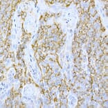 Immunohistochemistry - Anti-CD44 Antibody (A91308) - Antibodies.com