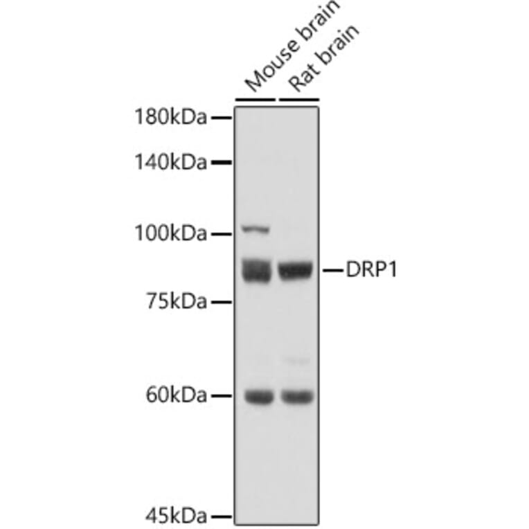 Western Blot - Anti-DRP1 Antibody (A91309) - Antibodies.com