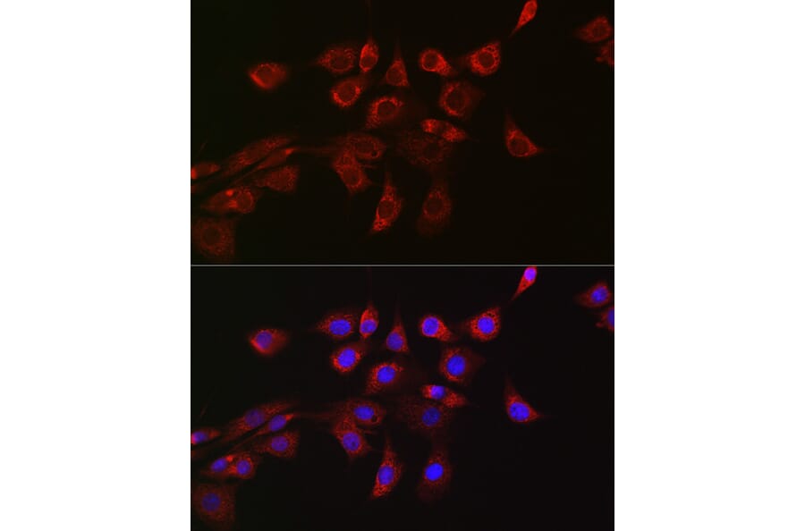 Immunofluorescence - Anti-DRP1 Antibody (A91309) - Antibodies.com