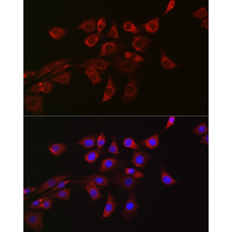 Immunofluorescence - Anti-DRP1 Antibody (A91309) - Antibodies.com