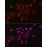 Immunofluorescence - Anti-DRP1 Antibody (A91309) - Antibodies.com