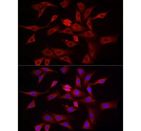 Immunofluorescence - Anti-DRP1 Antibody (A91310) - Antibodies.com