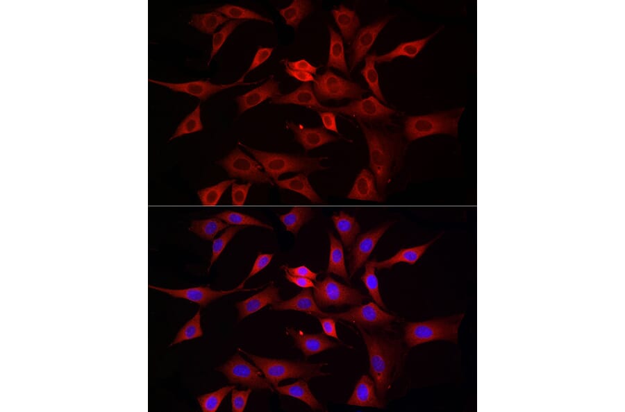 Immunofluorescence - Anti-DRP1 Antibody (A91310) - Antibodies.com