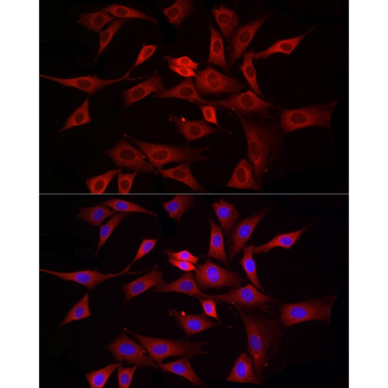 Immunofluorescence - Anti-DRP1 Antibody (A91310) - Antibodies.com